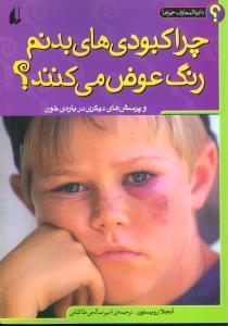 عکس چرا کبودهای بدنم رنگ عوض می‌کنند؟ و پرسش‌های دیگری دربارهٔ خون