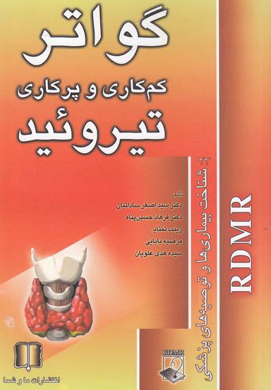 عکس گواتر