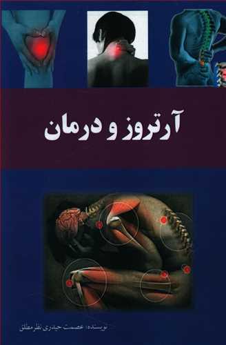 عکس آرتروز و درمان