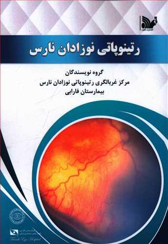 عکس رتینوپاتی نوزادان نارس، مرکز (آر او پی) بیمارستان فارابی