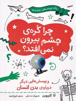 عکس یک پرسش علمی (چراکرهٔ‌چشم‌بیرون) فاطمی