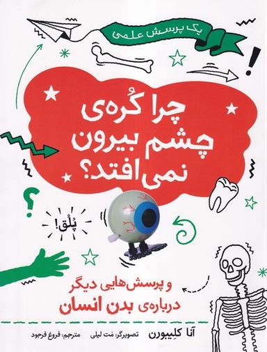 عکس یک پرسش علمی (چراکرهٔ‌چشم‌بیرون) فاطمی
