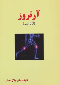 عکس آرتروز